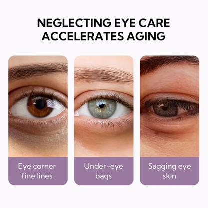 LANBENA - Rejuvenating Retinol Hydra‑Gel Eye Patches