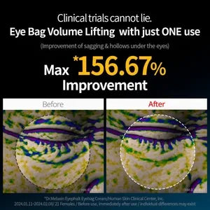 Dr Melaxin Eyephalt Eyecream